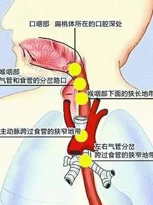 丧命式自救后，巨大鱼刺直扎心脏